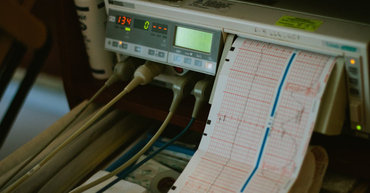 discover the cutting-edge technique of pulse alignment, a process that enhances precision and efficiency in various applications. uncover how this innovative method can optimize your performance and improve outcomes in your projects.