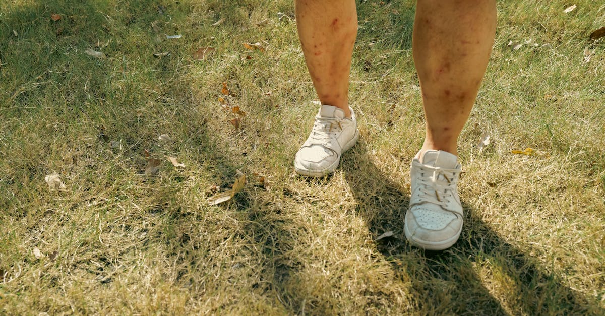 découvrez les causes, les symptômes et les options de traitement des blessures du plexus brachial. découvrez comment ces blessures affectent les nerfs contrôlant le bras et l'épaule et explorez des stratégies de rééducation pour retrouver force et mobilité.