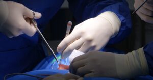 discover the causes, symptoms, and treatment options for herniated discs. understand how this common spinal condition can affect your daily life and learn effective ways to manage pain and improve mobility.