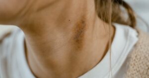 discover effective neck pain solutions to alleviate discomfort and improve your quality of life. explore expert tips, exercises, and treatments to relieve tension and promote a healthier neck.