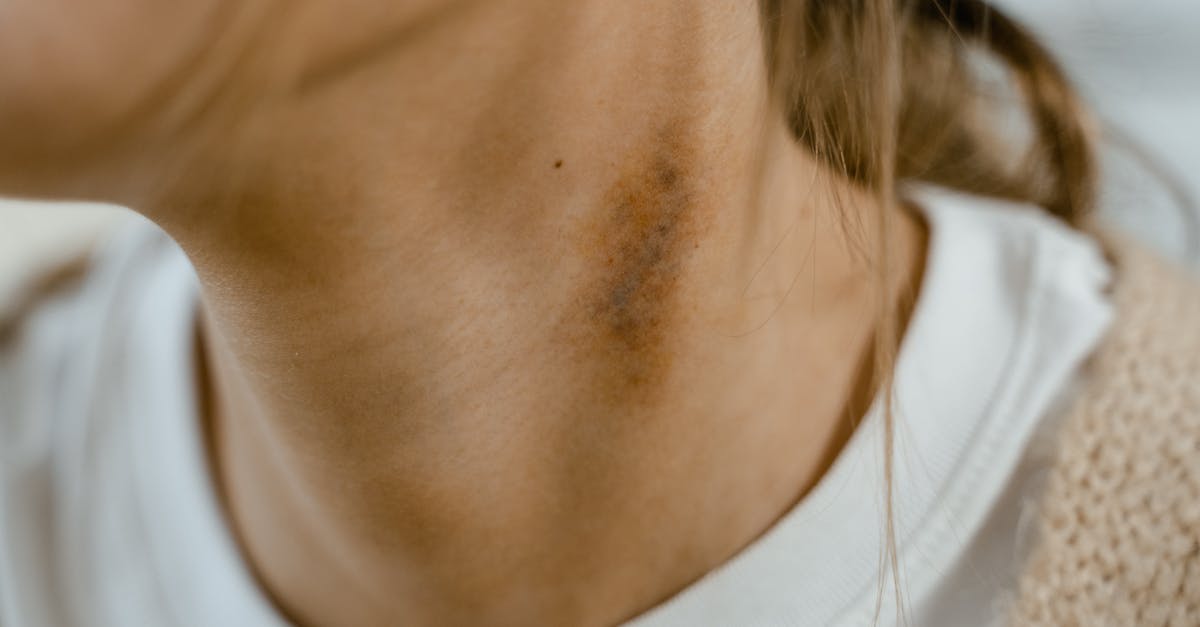 discover effective neck pain solutions to alleviate discomfort and improve your quality of life. explore expert tips, exercises, and treatments to relieve tension and promote a healthier neck.