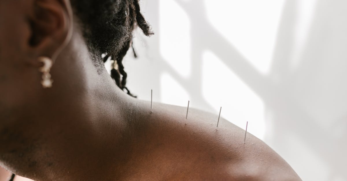 shoulder bursitis is an inflammatory condition affecting the bursa in the shoulder joint, causing pain, swelling, and limited mobility. learn about the causes, symptoms, and effective treatment options to relieve discomfort and restore function.