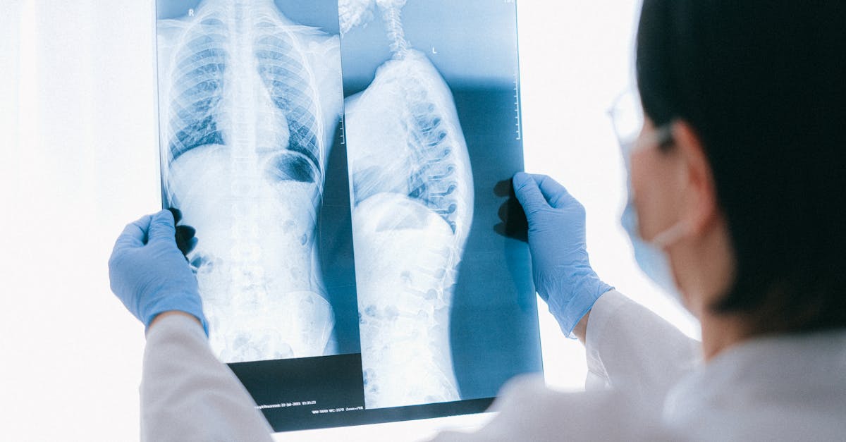 discover effective treatments and strategies to alleviate thoracic spine pain. learn about causes, symptoms, and expert advice to help you manage discomfort and improve your quality of life.