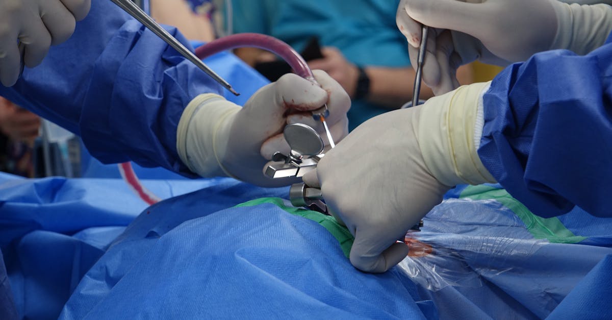 discover essential insights into spinal stenosis, a condition characterized by the narrowing of the spinal canal. learn about its causes, symptoms, and effective treatment options to manage pain and improve mobility.