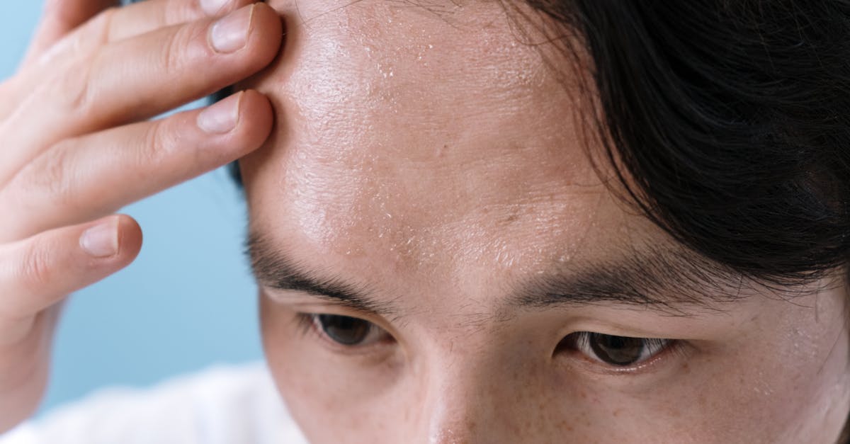 discover effective techniques and tips for managing tension headaches. learn about their causes, symptoms, and prevention strategies to relieve discomfort and improve your quality of life.