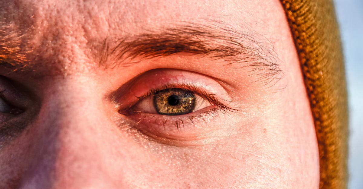 learn about eye strain, its symptoms, causes, and effective tips to reduce digital eye fatigue for healthier vision and overall eye comfort.