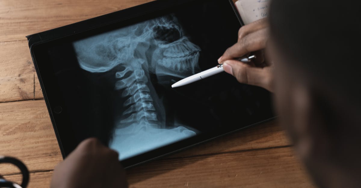 discover essential tips and expert advice on maintaining a healthy spine. learn about posture, exercises, and lifestyle habits to support your spinal health and prevent back pain.